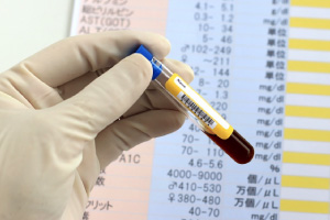 HIV（エイズ）診察のイメージ画像