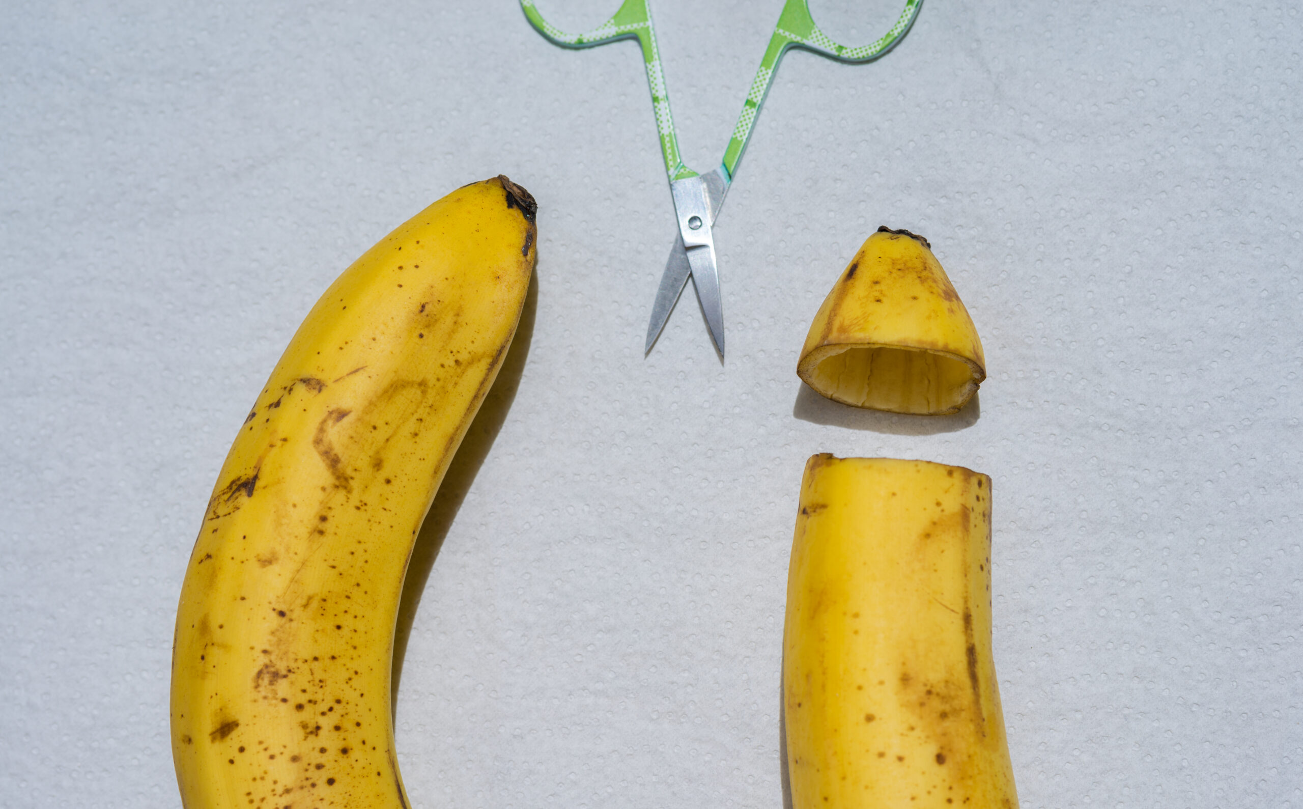 カントン包茎とは?症状・原因・治療法を専門医が解説